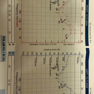 Audiogram.png