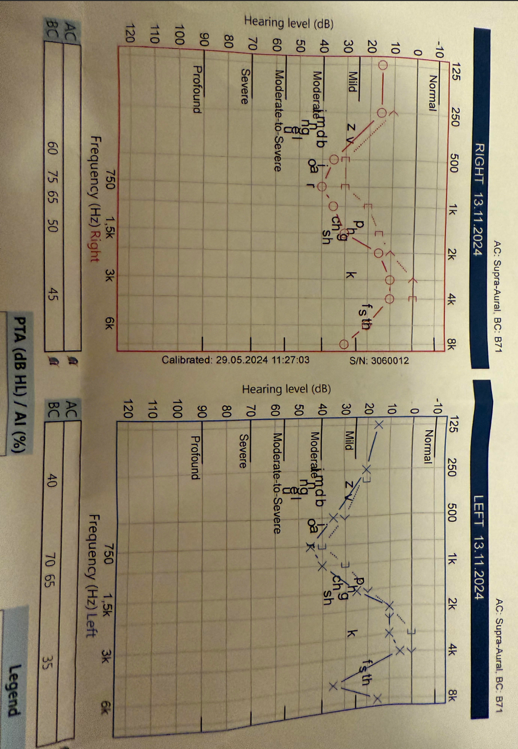 Audiogram.png